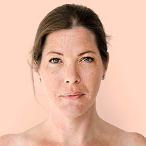 Client Image 3